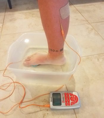 Phoenix Waveform water bucket therapy treatment with foot immersed in tub to reduce inflammation and calm irritated nerves using direct current stimulation