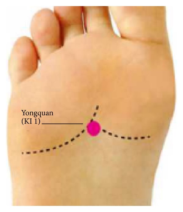 showing where to place the Phoenix Waveform direct current grounding attchment for pain relief and faster recovery